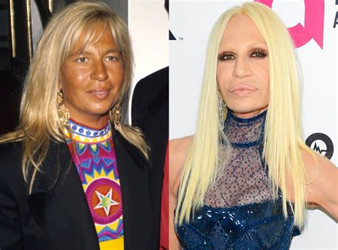 donatella versace avant operation|donatella versace face what happened.